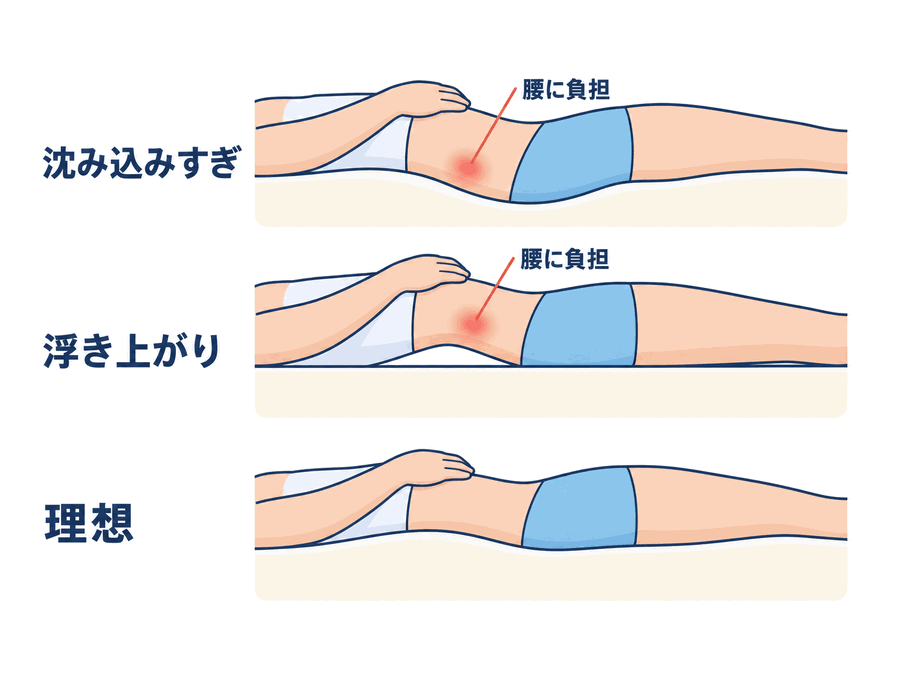 腰まわりの寝姿勢比較図。沈み込みすぎと浮き上がりはいずれも腰に負担がかかり、理想は腰までしっかり支えられている状態。