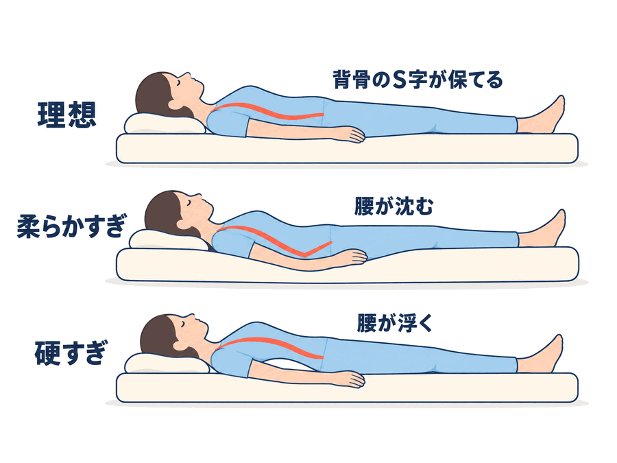 寝姿勢の比較図。理想は背骨のS字が保て、柔らかすぎると腰が沈み、硬すぎると腰が浮く。